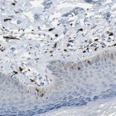 Immunohistochemistry-Paraffin: CPA3 Antibody [NBP1-86130] - Staining of human skin shows moderate to strong cytoplasmic positivity in mast cells.