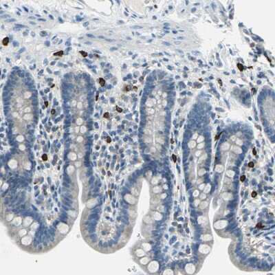 Immunohistochemistry-Paraffin: CPA3 Antibody [NBP1-86130] - Staining of human small intestine shows moderate to strong cytoplasmic positivity in mast cells.