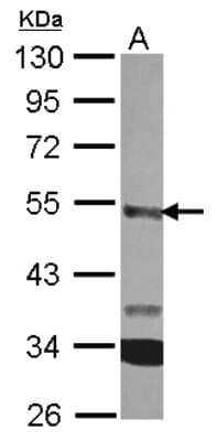 Western Blot: CPA3 Antibody [NBP2-15978] - Sample (30 ug of whole cell lysate) A: HeLa 10% SDS PAGE gel, diluted at 1:2000.