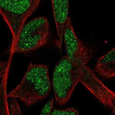 Immunocytochemistry/ Immunofluorescence CPA5 Antibody