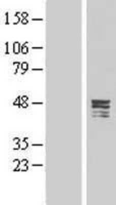 Western Blot: CPA5 Overexpression Lysate (Adult Normal) [NBL1-09427] Left-Empty vector transfected control cell lysate (HEK293 cell lysate); Right -Over-expression Lysate for CPA5.