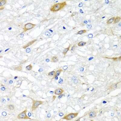 Immunohistochemistry-Paraffin: CPA6 Antibody [NBP2-92859] - Rat brain using CPA6 antibody  at dilution of 1:100 (40x lens).Perform microwave antigen retrieval with 10 mM PBS buffer pH 7.2 before commencing with IHC staining protocol.