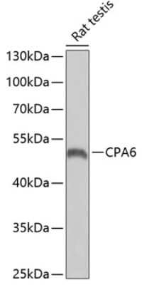 Western Blot: CPA6 Antibody [NBP2-92474] - Analysis of extracts of rat testis, using CPA6 at 1:1000 dilution.Secondary antibody: HRP Goat Anti-Rabbit IgG (H+L) at 1:10000 dilution.Lysates/proteins: 25ug per lane.Blocking buffer: 3% nonfat dry milk in TBST.Detection: ECL Basic Kit .Exposure time: 90s.