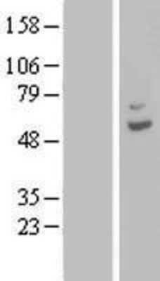 Western Blot: CPA6 Overexpression Lysate (Adult Normal) [NBL1-09428] Left-Empty vector transfected control cell lysate (HEK293 cell lysate); Right -Over-expression Lysate for CPA6.