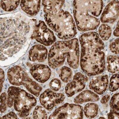 Immunohistochemistry CPAMD8 Antibody - BSA Free