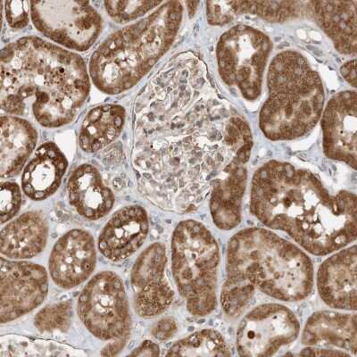 Immunohistochemistry: CPAMD8 Antibody [NBP2-38178] - Staining of human kidney shows strong cytoplasmic positivity in cells in tubules.