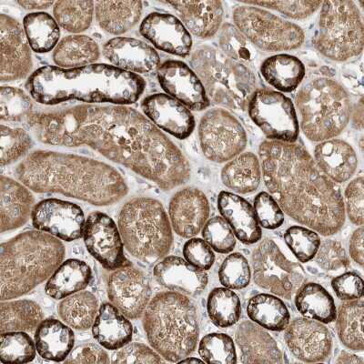 Immunohistochemistry CPAMD8 Antibody - BSA Free