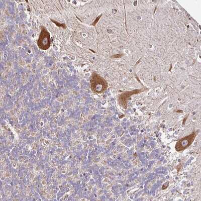 Immunohistochemistry-Paraffin: CPD Antibody [NBP2-13866] Staining of human cerebellum shows strong cytoplasmic positivity in Purkinje cells.