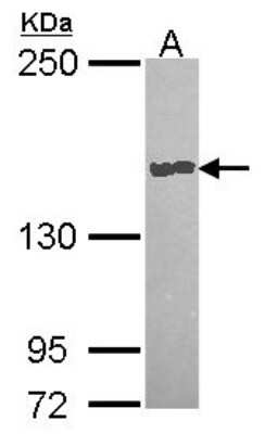 Western Blot: CPD Antibody [NBP2-15979] - Sample (30 ug of whole cell lysate) A: Hela 5% SDS PAGE gel, diluted at 1:1000.