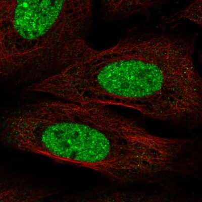 Immunocytochemistry/ Immunofluorescence CPEB3 Antibody - BSA Free
