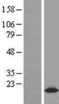 Western Blot: CPLX2 Overexpression Lysate (Adult Normal) [NBL1-09436] Left-Empty vector transfected control cell lysate (HEK293 cell lysate); Right -Over-expression Lysate for CPLX2.