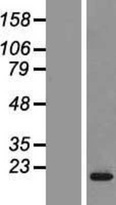 Western Blot: CPLX2 Overexpression Lysate (Adult Normal) [NBP2-07597] Left-Empty vector transfected control cell lysate (HEK293 cell lysate); Right -Over-expression Lysate for CPLX2.