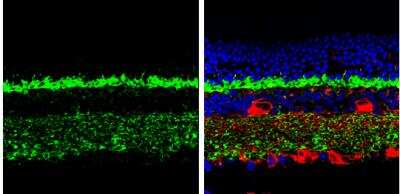 Immunohistochemistry-Paraffin CPLX3 Antibody