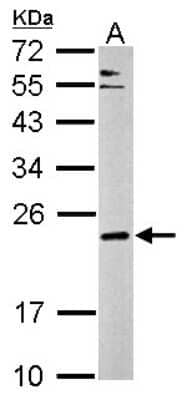 Western Blot CPLX3 Antibody