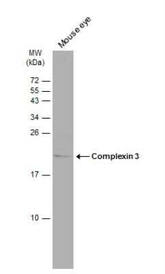 Western Blot CPLX3 Antibody