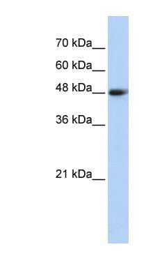 Western Blot: CPN1 Antibody [NBP1-58016] - Transfected 293T cell lysate, concentration 0.2-1 ug/ml.