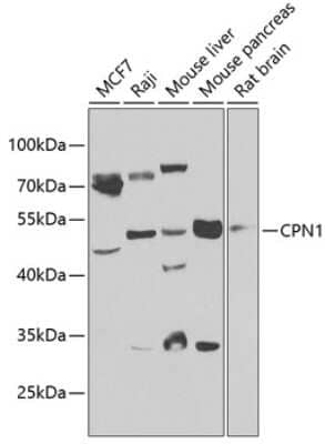 Western Blot: CPN1 Antibody [NBP2-92524] - Analysis of extracts of various cell lines, using CPN1 at 1:1000 dilution.Secondary antibody: HRP Goat Anti-Rabbit IgG (H+L) at 1:10000 dilution.Lysates/proteins: 25ug per lane.Blocking buffer: 3% nonfat dry milk in TBST.Detection: ECL Basic Kit .Exposure time: 20s.