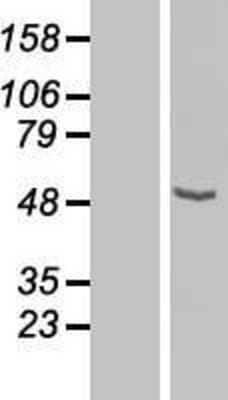 Western Blot: CPN1 Overexpression Lysate (Adult Normal) [NBL1-09440] Left-Empty vector transfected control cell lysate (HEK293 cell lysate); Right -Over-expression Lysate for CPN1.