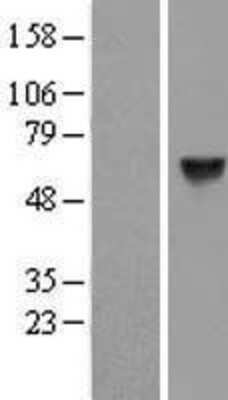 Western Blot: CPNE1 Overexpression Lysate (Adult Normal) [NBP2-05296] Left-Empty vector transfected control cell lysate (HEK293 cell lysate); Right -Over-expression Lysate for CPNE1.