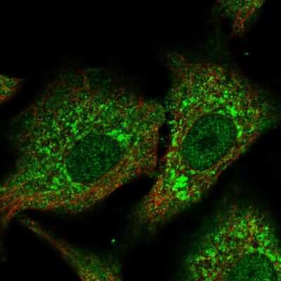 Immunocytochemistry/ Immunofluorescence CPNE2 Antibody - BSA Free