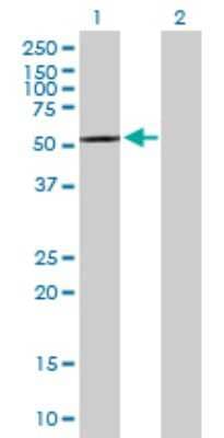 Western Blot: CPNE4 Antibody [H00131034-B01P] - Analysis of CPNE4 expression in transfected 293T cell line by CPNE4 polyclonal antibody.  Lane 1: CPNE4 transfected lysate(61.27 KDa). Lane 2: Non-transfected lysate.