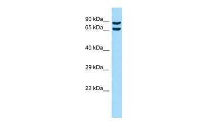 Western Blot: CPNE8 Antibody [NBP2-82755] - Host: Rabbit. Target Name: CPNE8. Sample Type: HT1080 Whole Cell lysates. Antibody Dilution: 1.0ug/ml