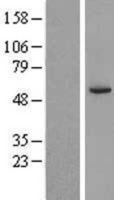 Western Blot: CPNE8 Overexpression Lysate (Adult Normal) [NBP2-05238] Left-Empty vector transfected control cell lysate (HEK293 cell lysate); Right -Over-expression Lysate for CPNE8.