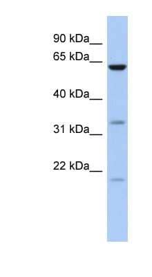 Western Blot: CPNE9 Antibody [NBP1-70508] - 721_B cell lysate, concentration 0.2-1 ug/ml.