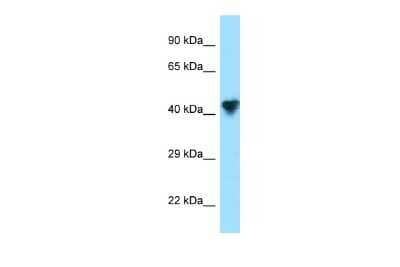 Western Blot: CPO Antibody [NBP2-83982] - WB Suggested Anti-CPO Antibody. Titration: 1.0 ug/ml. Positive Control: 293T Whole Cell