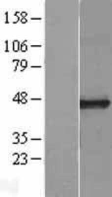 Western Blot: CPO Overexpression Lysate (Adult Normal) [NBL1-09445] Left-Empty vector transfected control cell lysate (HEK293 cell lysate); Right -Over-expression Lysate for CPO.