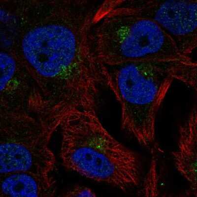 Immunocytochemistry/Immunofluorescence: CPR8 Antibody [NBP2-58926] - Staining of human cell line SK-MEL-30 shows localization to the Golgi apparatus.