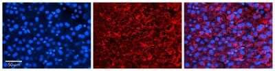 Immunohistochemistry: CPR8 Antibody [NBP1-70758] - Formalin Fixed Paraffin Embedded Tissue: Human Liver Tissue Observed Staining: Cytoplasm and plasma membrane in hepatocytes and endothelial cells in sinusoids Primary Antibody Concentration: N/A Other Working Concentrations: 1:600 Secondary Antibody: Donkey anti-Rabbit-Cy3 Secondary Antibody Concentration: 1:200 Magnification: 20X Exposure Time: 0.5 - 2.0 sec