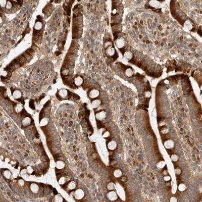 Immunohistochemistry: CPR8 Antibody [NBP1-87954] - Staining of human duodenum shows strong cytoplasmic positivity in glandular cells.
