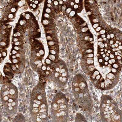 Immunohistochemistry-Paraffin: CPR8 Antibody [NBP1-87954] - Staining of human small intestine shows strong cytoplasmic positivity in glandular cells.