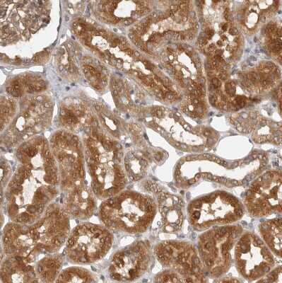 Immunohistochemistry-Paraffin: CPR8 Antibody [NBP1-87954] - Staining of human kidney shows strong cytoplasmic positivity in cells in tubules.