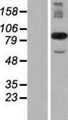 Western Blot CPR8 Overexpression Lysate