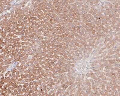 Immunohistochemistry-Paraffin: CPS1 Antibody (JB40-33) [NBP2-75445] - Analysis of paraffin-embedded rat liver tissue with Rabbit anti-CPS1 antibody washed with ddH2O and PBS, and then probed with the primary antibody  at 1/200 dilution for 1 hour at room temperature. The detection was performed using an HRP conjugated compact polymer system. DAB was used as the chromogen. Tissues were counterstained with hematoxylin and mounted with DPX.
