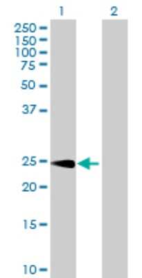 Western Blot: CPSF4 Antibody [H00010898-B02P] - Analysis of CPSF4 expression in transfected 293T cell line by CPSF4 polyclonal antibody.  Lane 1: CPSF4 transfected lysate(26.73 KDa). Lane 2: Non-transfected lysate.