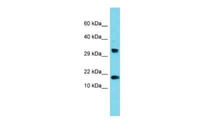 Western Blot: CPSF4L Antibody [NBP2-82756] - Host: Rabbit. Target Name: CPSF4L. Sample Type: 293T Whole Cell lysates. Antibody Dilution: 1.0ug/ml