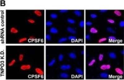 Immunocytochemistry/Immunofluorescence: CPSF6 Antibody [NB100-61596] - TNPO3 K.D. and shRNA control HeLa cells were transiently transfected using constructs expressing FLAG-tagged CPSF6. Twenty-four hours post-transfection cells were fixed and immunostained using anti-FLAG antibodies. The nuclear compartment was labeled using DAPI.Image collected and cropped by CiteAb from the following publication (//pubmed.ncbi.nlm.nih.gov/23622145/) licensed under a CC-BY license.