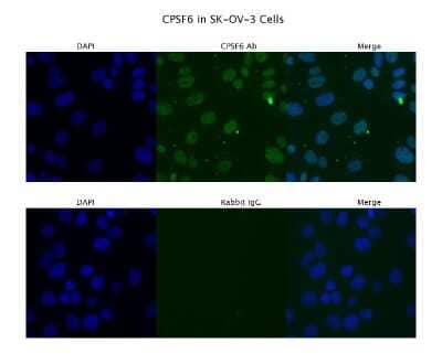 Immunocytochemistry/Immunofluorescence: CPSF6 Antibody [NBP1-57541] - SKOV3  Primary Antibody Dilution: 4 ug/ml  Secondary Antibody : Anti-rabbit Alexa 546  Secondary Antibody Dilution: 2 ug/ml