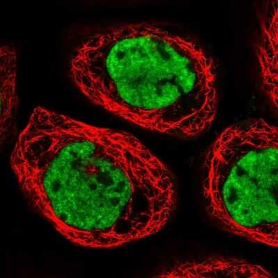 Immunocytochemistry/Immunofluorescence: CPSF6 Antibody [NBP1-85676] - Staining of human cell line A-431 shows localization to nucleoplasm & nuclear speckles. Antibody staining is shown in green.