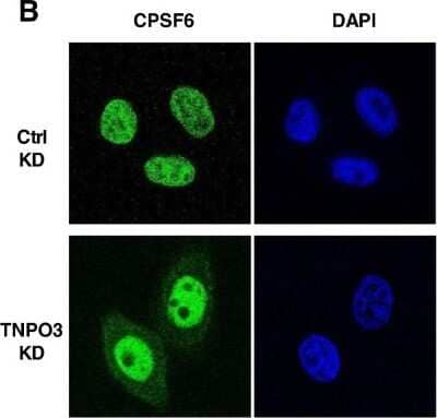 Immunocytochemistry/Immunofluorescence: CPSF6 Antibody [NBP1-85676] - TNPO3 KD inhibits HIV-1 replication by shifting CPSF6 to the cytoplasm. Immuno-fluorescence localization of endogenous CPSF6 (green) in control (Ctrl) KD or TNPO3 KD TZM-bl cells. DAPI staining (blue) was used to mark the nuclear compartment. Image collected and cropped by CiteAb from the following publication (//retrovirology.biomedcentral.com/articles/10.1186/1742-4690-10-20), licensed under a CC-BY license.