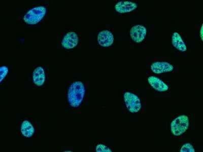 Immunocytochemistry/Immunofluorescence: CPSF6 Antibody [NBP2-99189] - Immunofluorescence staining of CPSF6 in Hela cells. Cells were fixed with 4% PFA, permeabilzed with 0.3% Triton X-100 in PBS, blocked with 10% serum, and incubated with rabbit anti-human CPSF6 polyclonal antibody (1:1000) at 4C overnight. Then cells were stained with the Alexa Fluor(R)488-conjugated Goat Anti-rabbit IgG secondary antibody (green) and counterstained with DAPI (blue). Positive staining was localized to nucleus.