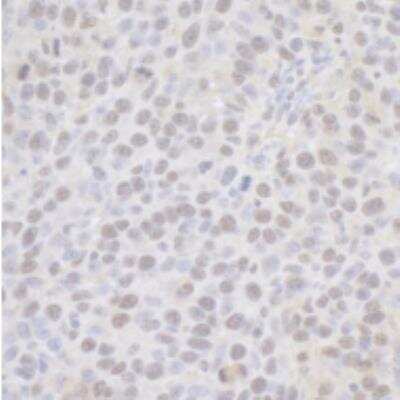 Immunohistochemistry-Paraffin: CPSF6 Antibody [NB100-61596] - FFPE section of mouse renal cell carcinoma. Antibody: Affinity purified rabbit anti-CPSF68 used at a dilution of 1:200 (1ug/ml). Detection: DAB