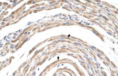 Immunohistochemistry-Paraffin: CPSF6 Antibody [NBP1-57541] - Human Muscle Tissue, Skeletal muscle cells (Indicated with Arrows) 4-8ug/ml.