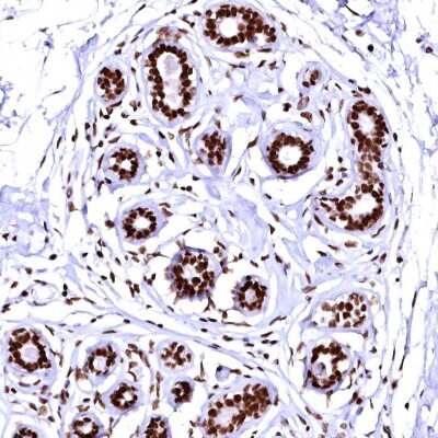 Immunohistochemistry-Paraffin CPSF6 Antibody