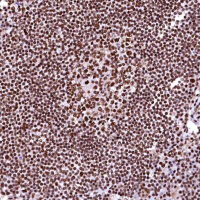 Immunohistochemistry-Paraffin: CPSF6 Antibody [NBP1-85676] - Staining of human lymph node shows strong nuclear positivity in lymphoid cells.