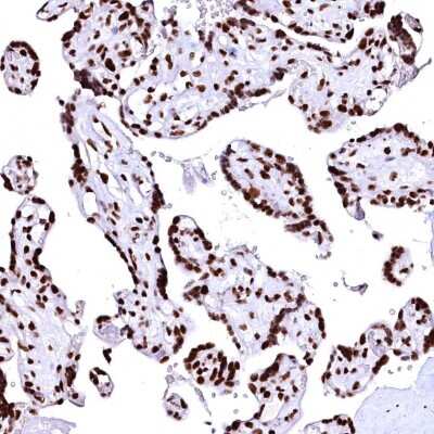 Immunohistochemistry-Paraffin CPSF6 Antibody