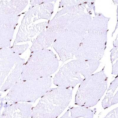 Immunohistochemistry-Paraffin: CPSF6 Antibody [NBP1-85676] - Staining of human skeletal muscle shows strong nuclear positivity in myocytes.